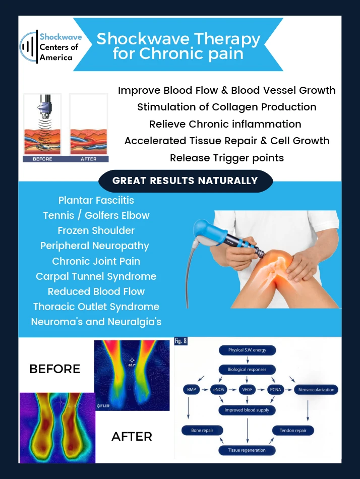 Chiropractic Greenville SC Shockwave Therapy For Chronic Pain